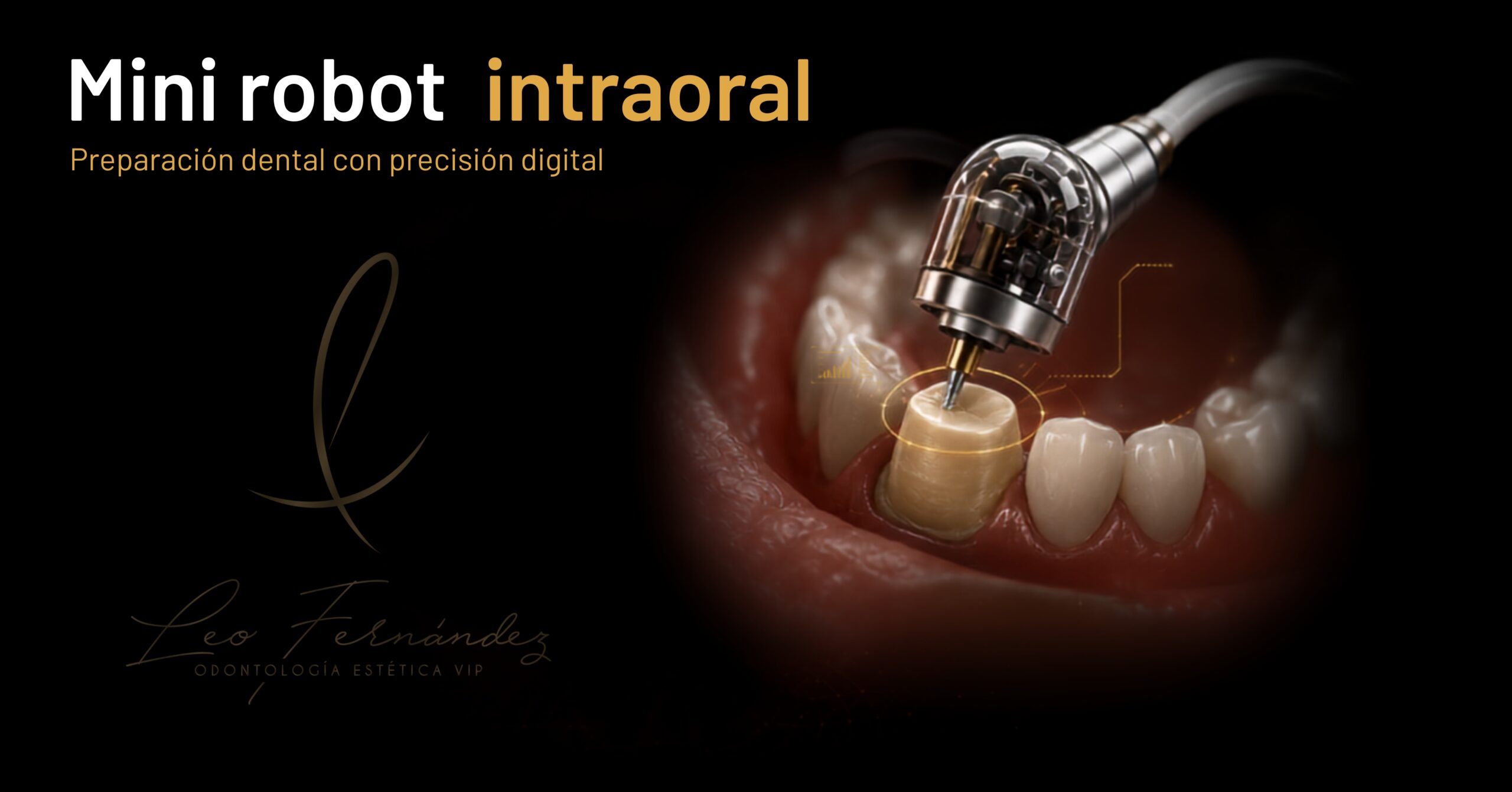 Mini robot dental intraoral que ejecuta preparaciones dentales planificadas digitalmente