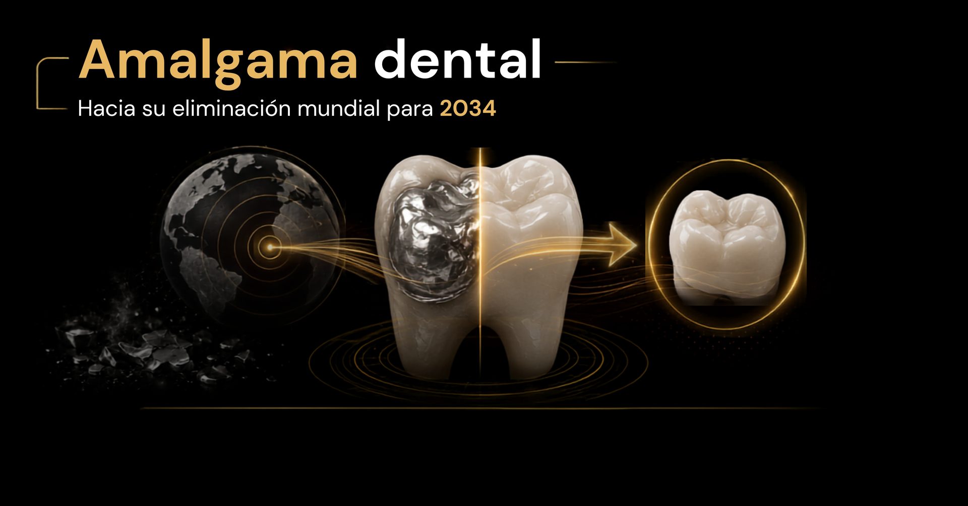 Amalgama dental y su eliminación mundial para 2034 según el Convenio de Minamata