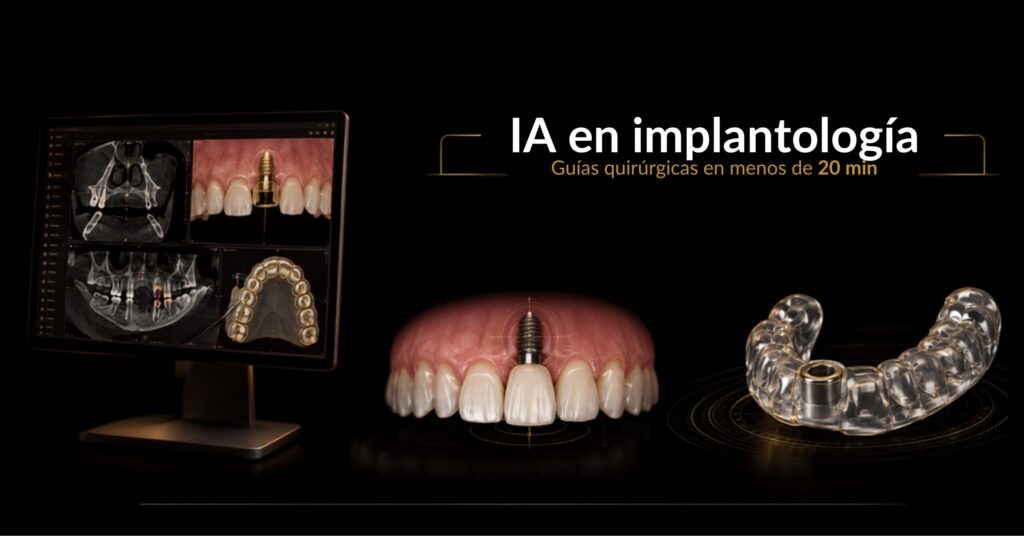 Inteligencia artificial en odontología usada para diseñar la guía quirúrgica de un implante dental